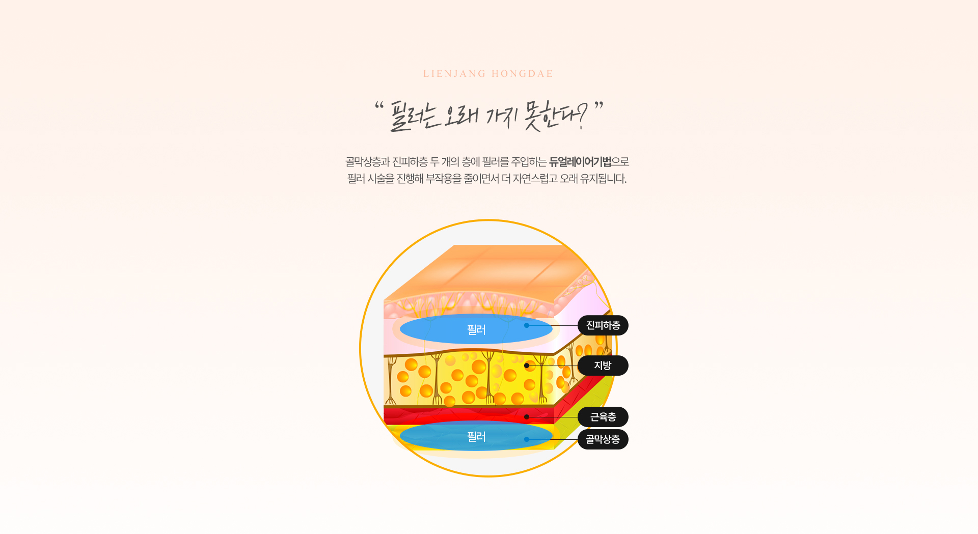 리엔장 동안필러 듀얼레이어기법