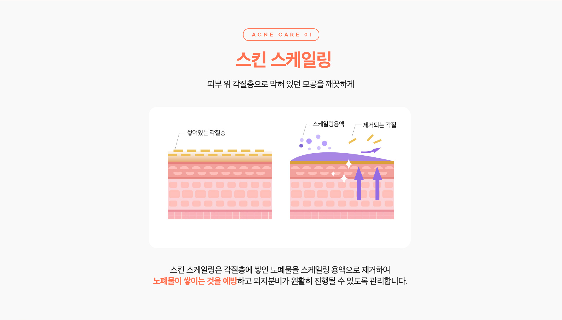 리엔장 여드름케어 스킨스케일링
