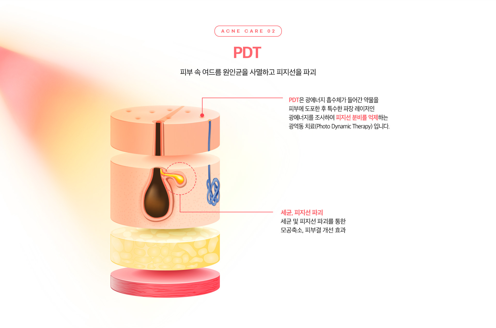 리엔장 여드름케어 PDT