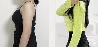 바디 시술 전후 썸네일 5