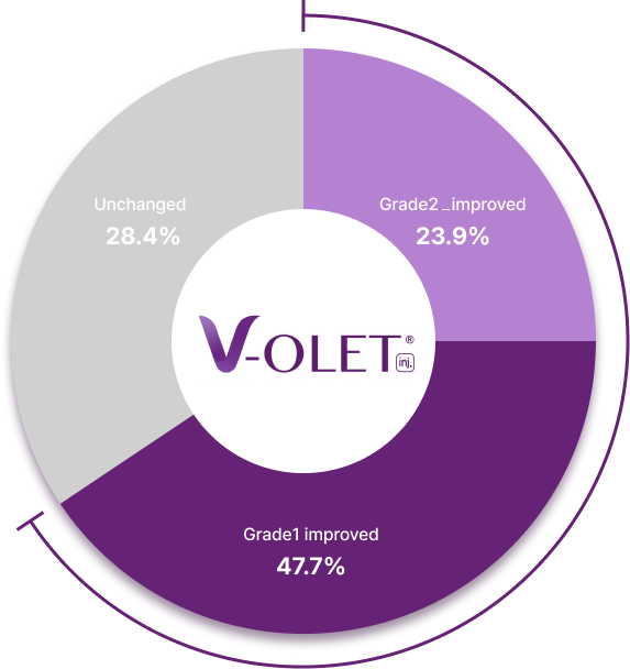 브이올렛 시술 효과 인포그래픽